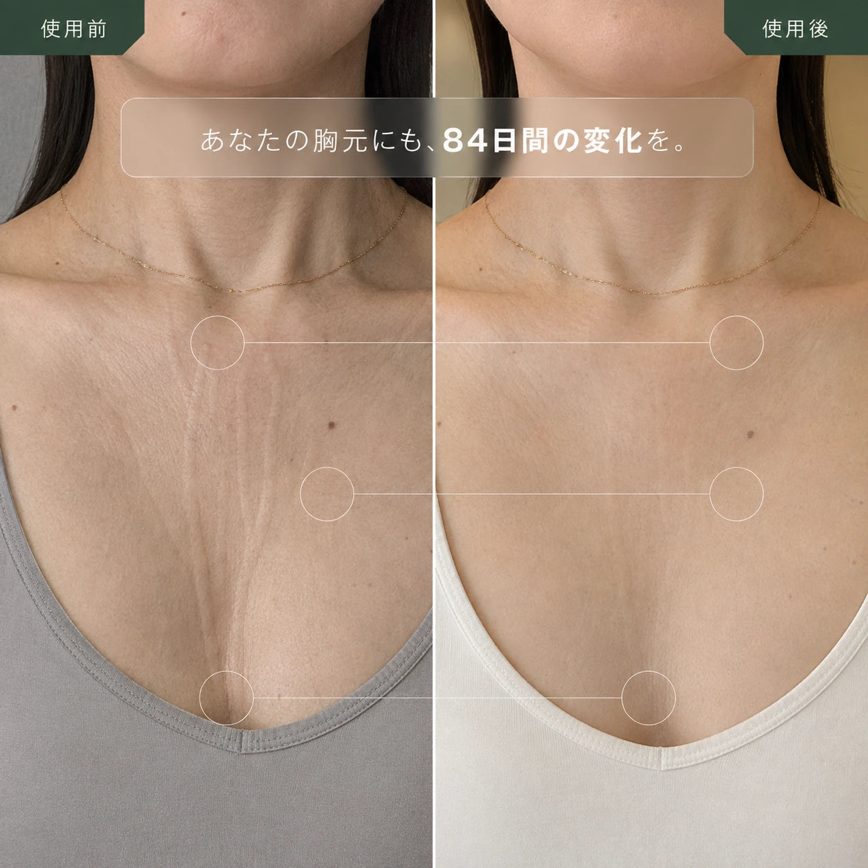 寝ジワ対策 デコルテ用シリコーンパッド ― 100%天然シリコン
