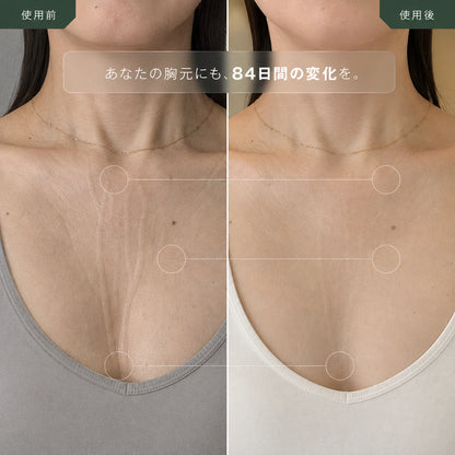 寝ジワ対策 デコルテ用シリコーンパッド ― 100%天然シリコン