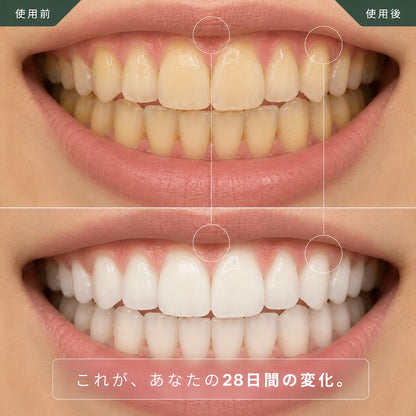 プロ仕様 Wライト ホワイトニングキット ― 青色・赤色LED＋PAPジェル