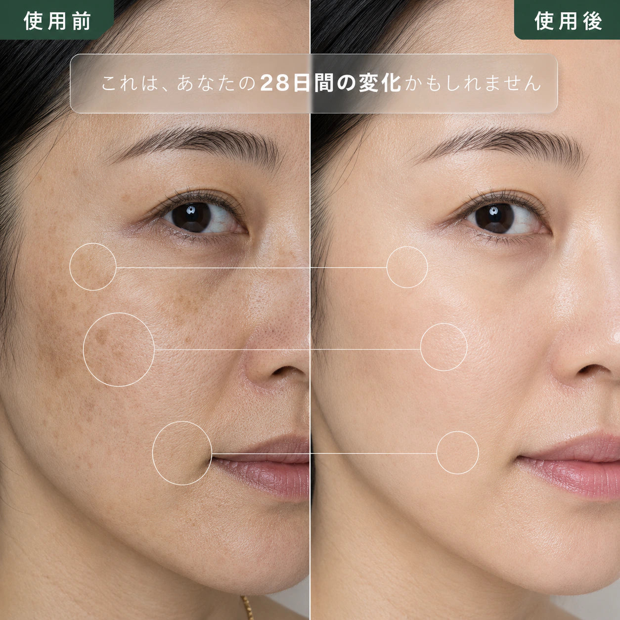 プロ仕様 LED美顔マスク — 赤色光と850nm近赤外線の光ケア